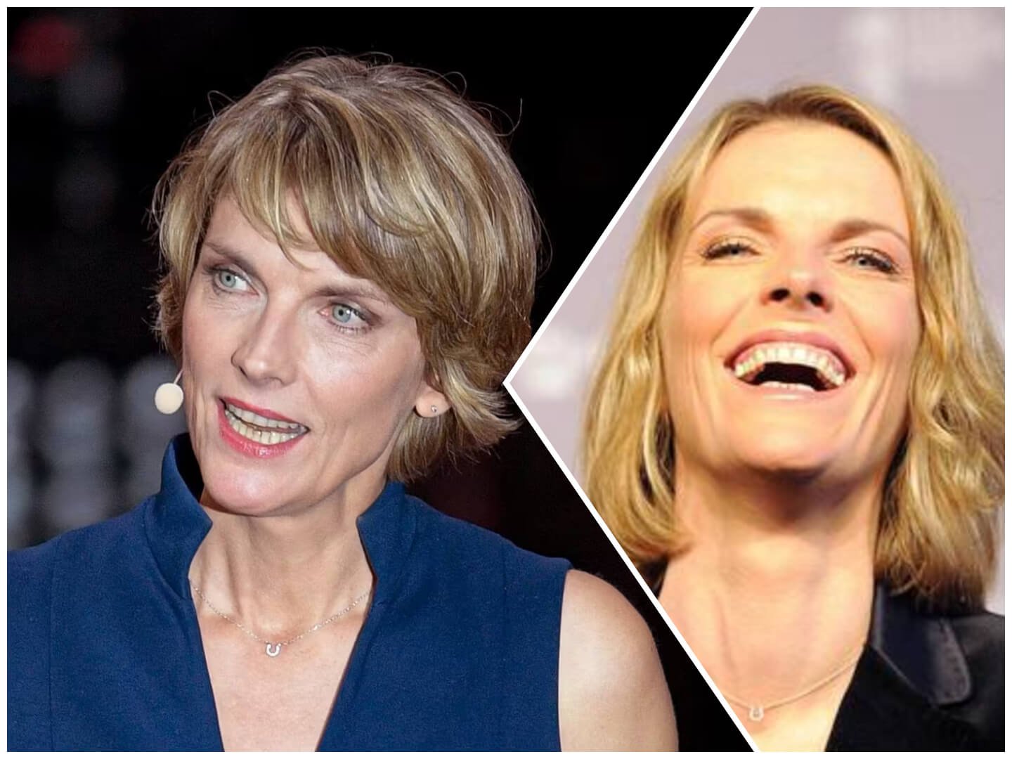 Marietta Slomka Brustkrebs – Fakten, Hintergründe und medizinische Einordnung